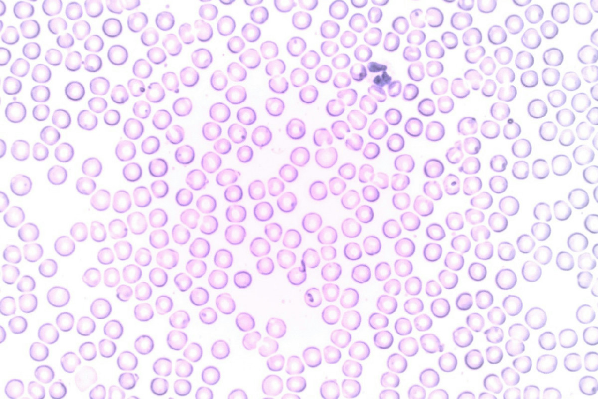 Gli eccessi di alcol compromettono la salute intestinale: i rischi legati alle bevute pesanti